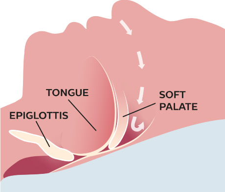 Osa breathing